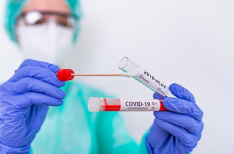 coronavirus, covid, tamponi